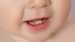 تب کردن کودکان را به حساب دندان درآوردن نگذارید