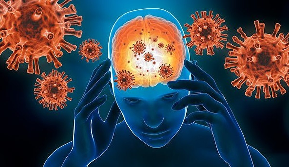 عوارض مغزی کرونا در چه بیمارانی بروز می‌کند/آیا عوارض مغزی کرونا ماندگار است؟