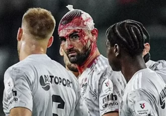 مصدومیت شدید سردار دورسون در لیگ ترکیه